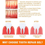 إيلهو - أمبولات خلاصة إصلاح اللثة