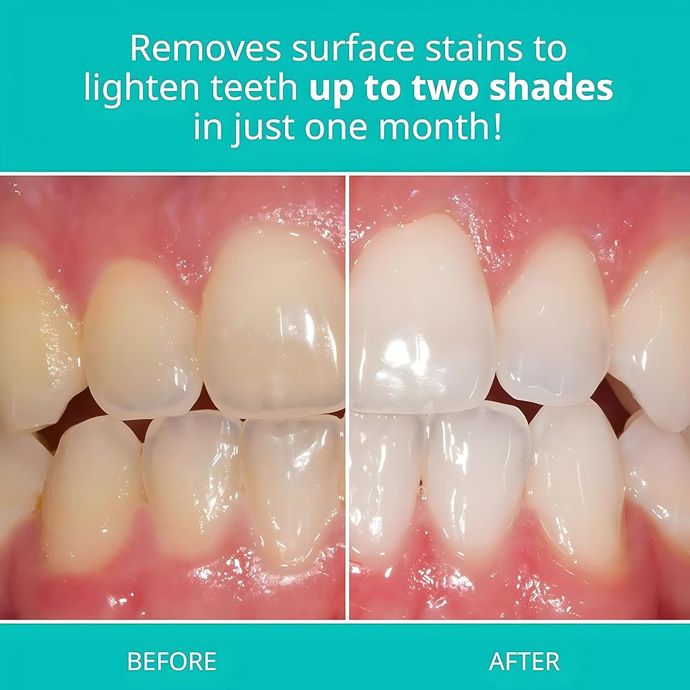 Opalescence - Whitening Toothpaste