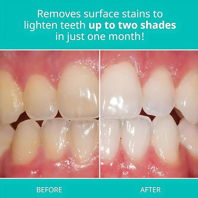 Opalescence - Whitening Toothpaste