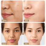 Before and after comparison of facial skin treatment on a woman's face.