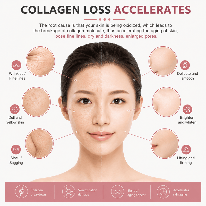 Diagram showing the effects of collagen loss on skin with a woman's face and labeled skin issues.