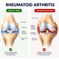 Rheumatoid Arthritis Pain Relief Cream (20ml) - thumbnail 6