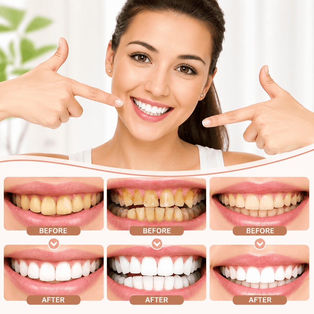 Woman pointing to her smile with 'before' and 'after' tooth whitening comparisons.